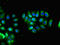 Tetraspan membrane protein of hair cell stereocilia antibody, LS-C678482, Lifespan Biosciences, Immunofluorescence image 