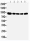 Oxysterol Binding Protein antibody, PA1949, Boster Biological Technology, Western Blot image 