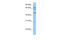 Testis Specific Serine Kinase Substrate antibody, 30-928, ProSci, Western Blot image 