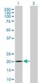 SPANX Family Member B1 antibody, H00728695-B01P, Novus Biologicals, Western Blot image 