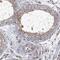 Leucine Rich Repeat Containing 28 antibody, PA5-58764, Invitrogen Antibodies, Immunohistochemistry frozen image 