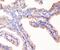 Tight Junction Protein 1 antibody, M00860, Boster Biological Technology, Immunohistochemistry paraffin image 