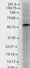 Gamma-Aminobutyric Acid Type A Receptor Beta3 Subunit antibody, TA326474, Origene, Western Blot image 