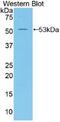 Mesothelin antibody, MBS2004878, MyBioSource, Western Blot image 