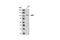 Janus Kinase 3 antibody, 3775T, Cell Signaling Technology, Western Blot image 