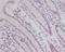 Aryl Hydrocarbon Receptor Nuclear Translocator antibody, M02263, Boster Biological Technology, Immunohistochemistry frozen image 