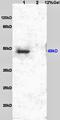 Colony Stimulating Factor 3 Receptor antibody, orb13429, Biorbyt, Western Blot image 