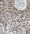 KH Domain Containing 4, Pre-MRNA Splicing Factor antibody, FNab04538, FineTest, Immunohistochemistry frozen image 