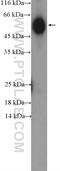 Immunoglobulin Heavy Constant Gamma 4 (G4m Marker) antibody, 16402-1-AP, Proteintech Group, Western Blot image 