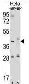 Hyaluronidase 2 antibody, LS-C165094, Lifespan Biosciences, Western Blot image 