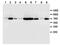Plasminogen Activator, Urokinase Receptor antibody, ab103791, Abcam, Western Blot image 