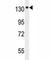 Neurotrophic Receptor Tyrosine Kinase 1 antibody, F40240-0.4ML, NSJ Bioreagents, Western Blot image 