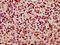 Kinesin Family Member 3C antibody, CSB-PA012337LA01HU, Cusabio, Immunohistochemistry frozen image 