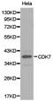 Cyclin Dependent Kinase 7 antibody, A00552-1, Boster Biological Technology, Western Blot image 