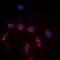 Bone Marrow Stromal Cell Antigen 1 antibody, orb213618, Biorbyt, Immunofluorescence image 