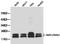 NME/NM23 Nucleoside Diphosphate Kinase 1 antibody, LS-C192674, Lifespan Biosciences, Western Blot image 