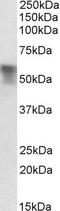 Serpin Family A Member 6 antibody, STJ72511, St John