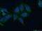 Keratin 18 antibody, 18708-1-AP, Proteintech Group, Immunofluorescence image 