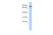 RNA Exonuclease 5 antibody, A30160, Boster Biological Technology, Western Blot image 