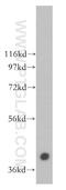 Calcium Voltage-Gated Channel Auxiliary Subunit Gamma 3 antibody, 13729-1-AP, Proteintech Group, Western Blot image 