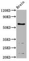 Acid Sensing Ion Channel Subunit 1 antibody, LS-C680181, Lifespan Biosciences, Western Blot image 