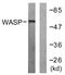 WASP antibody, LS-C117729, Lifespan Biosciences, Western Blot image 