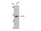 Phosphatase And Tensin Homolog antibody, STJ95257, St John