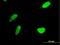 3'-Phosphoadenosine 5'-Phosphosulfate Synthase 2 antibody, H00009060-B01P, Novus Biologicals, Immunofluorescence image 