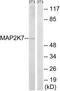 Mitogen-Activated Protein Kinase Kinase Kinase 7 antibody, TA326083, Origene, Western Blot image 