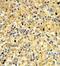 Favine antibody, GTX81055, GeneTex, Immunohistochemistry paraffin image 