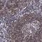 MICA3 antibody, HPA000639, Atlas Antibodies, Immunohistochemistry paraffin image 