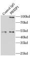 PBX Homeobox Interacting Protein 1 antibody, FNab06185, FineTest, Immunoprecipitation image 