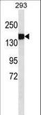 Collagen Type III Alpha 1 Chain antibody, LS-C159386, Lifespan Biosciences, Western Blot image 