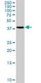 Ribonucleotide Reductase Regulatory Subunit M2 antibody, H00006241-M01, Novus Biologicals, Western Blot image 