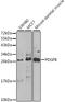 Proto-oncogene c-Sis antibody, GTX54575, GeneTex, Western Blot image 