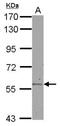 Aldehyde Dehydrogenase 6 Family Member A1 antibody, NBP2-15341, Novus Biologicals, Western Blot image 