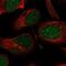 PHD finger protein 1 antibody, NBP1-82613, Novus Biologicals, Immunocytochemistry image 