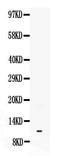 Neuropeptide Y antibody, LS-C357484, Lifespan Biosciences, Western Blot image 