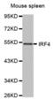 Interferon Regulatory Factor 4 antibody, abx000742, Abbexa, Western Blot image 