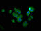 Trichoplein Keratin Filament Binding antibody, LS-C379690, Lifespan Biosciences, Immunofluorescence image 