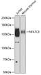 Nuclear Factor Of Activated T Cells 3 antibody, 22-392, ProSci, Western Blot image 