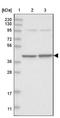 Selenophosphate Synthetase 1 antibody, NBP1-87008, Novus Biologicals, Western Blot image 