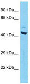 TOR antibody, TA344421, Origene, Western Blot image 