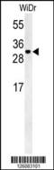 TM2 Domain Containing 3 antibody, 61-902, ProSci, Western Blot image 