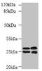 Carboxymethylenebutenolidase Homolog antibody, CSB-PA846604LA01HU, Cusabio, Western Blot image 
