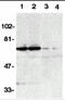 TNF Receptor Superfamily Member 21 antibody, 2157, ProSci Inc, Western Blot image 