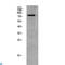 G Protein-Coupled Receptor Kinase 2 antibody, LS-C813579, Lifespan Biosciences, Western Blot image 