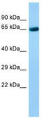 Acyl-CoA Oxidase Like antibody, TA332183, Origene, Western Blot image 