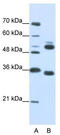 WD Repeat Domain 6 antibody, TA346001, Origene, Western Blot image 