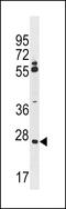 Canopy FGF Signaling Regulator 3 antibody, 60-011, ProSci, Western Blot image 